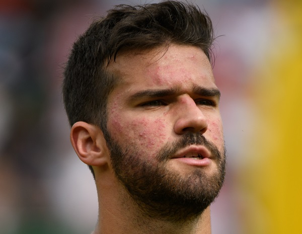 Alisson Liverpool Brasile